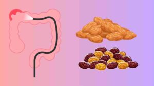 Are Raisins Good for IBS?