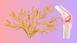 Is Sea Moss Good for Arthritis?